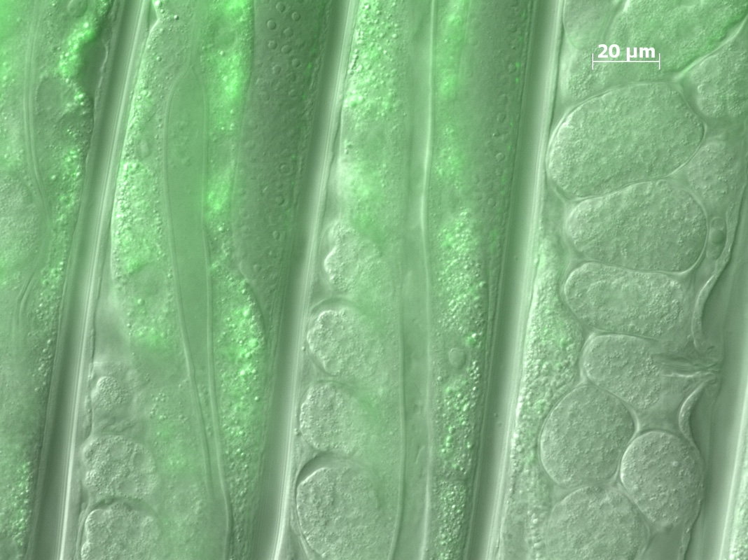 green fluorescence all over